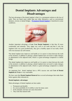Dental Implants Advantages and Disadvantages