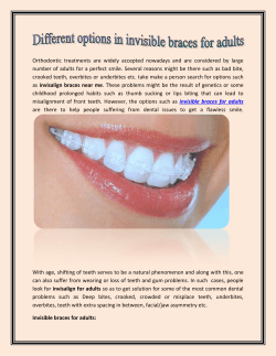 Different options in Invisible Braces for Adults