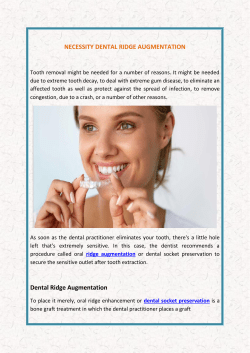 Necessity Dental Ridge Augmentation