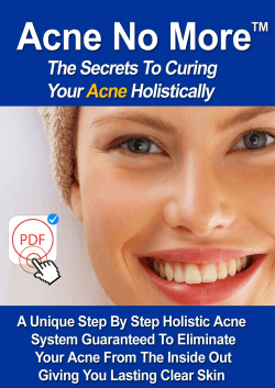 Acne No More PDF EBook Mike Walden Download Valuable Report