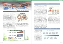 冠動脈インターベンションの歴史