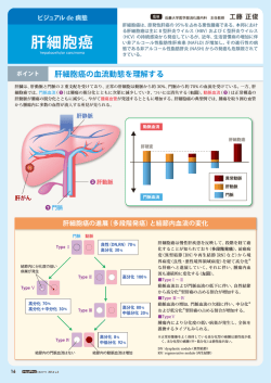 肝細胞癌の血流動態を理解する