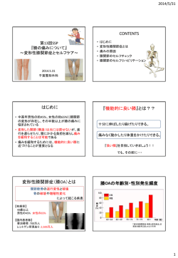 第13回 膝の痛みについて～変形性膝関節症とセルフケア