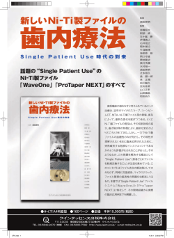 新しいNi−Ti製ファイルの