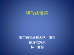 眼形成疾患 - 東京医科歯科大学 眼科学教室