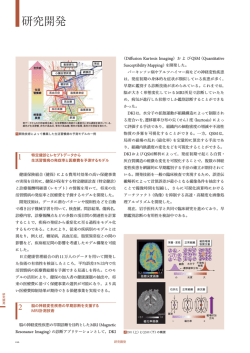 研究開発 - 日立評論