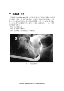 Ⅴ 尿道造影（UG）（PDF）