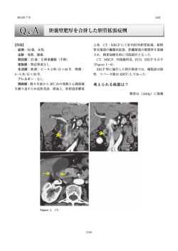 胆囊壁肥厚を合併した胆管拡張症例;pdf