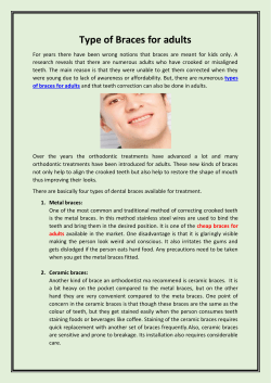 Type of Braces for adults