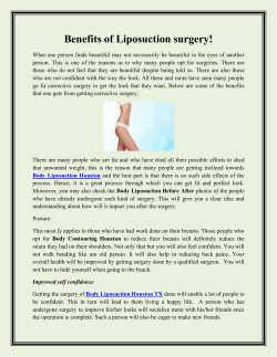 Benefits of Liposuction surgery