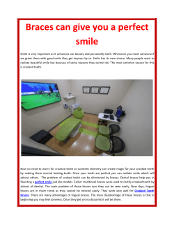 Braces can give you a perfect smile