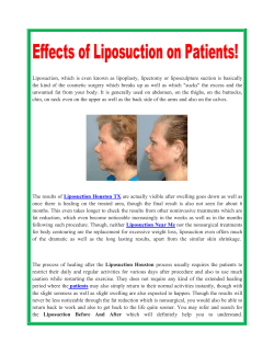 Effects of Liposuction on Patients