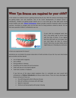 When Tpa Braces are required for your child
