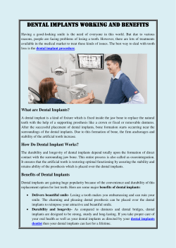 DENTAL IMPLANTS- WORKING AND BENEFITS