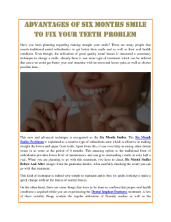 Advantages of Six Months Smile To Fix your Teeth Problem