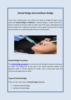 Dental Bridge And Cantilever Bridge